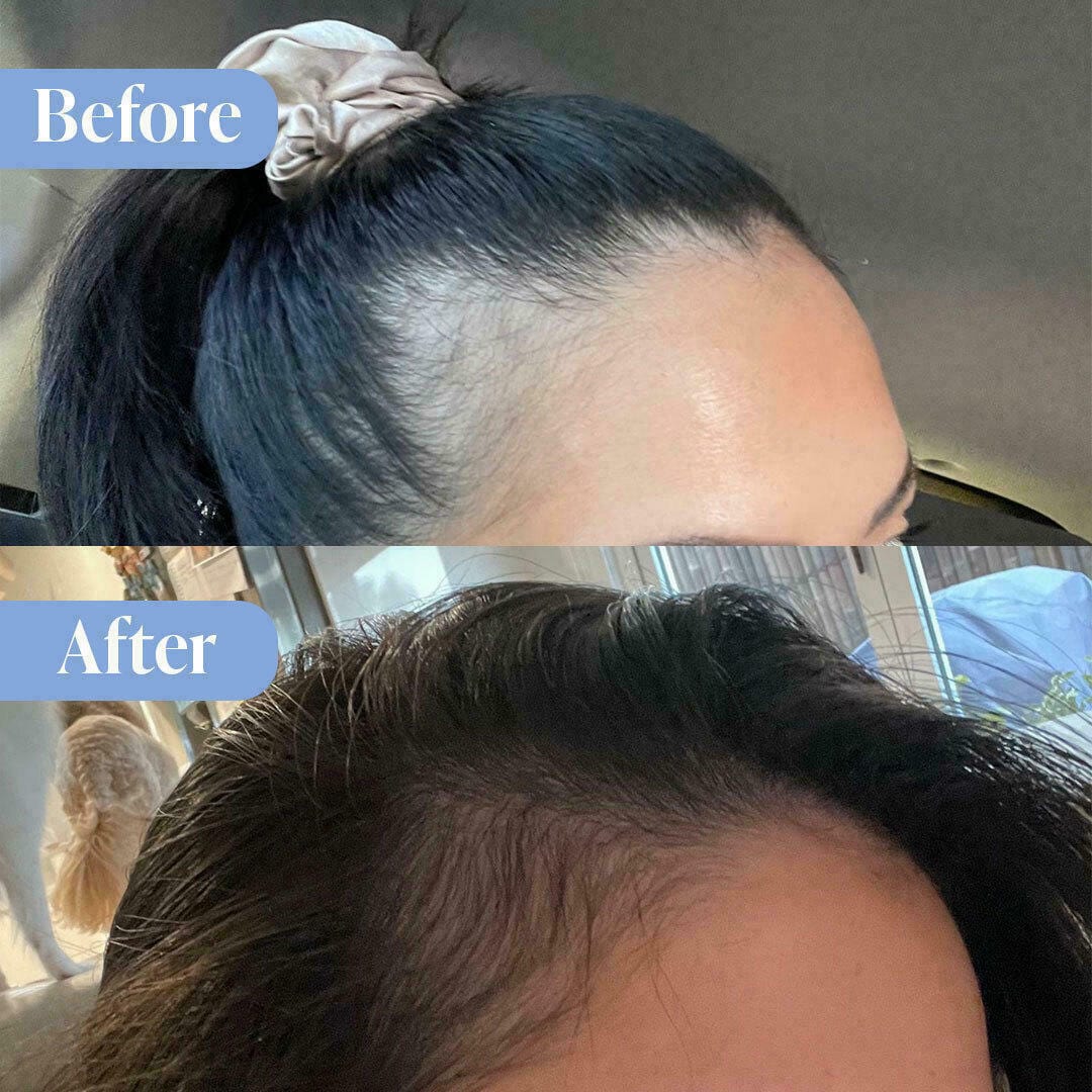 Anti-Hair Loss Shampoo & Conditioner + Hair & Scalp Leave-In Treatment - Image 3