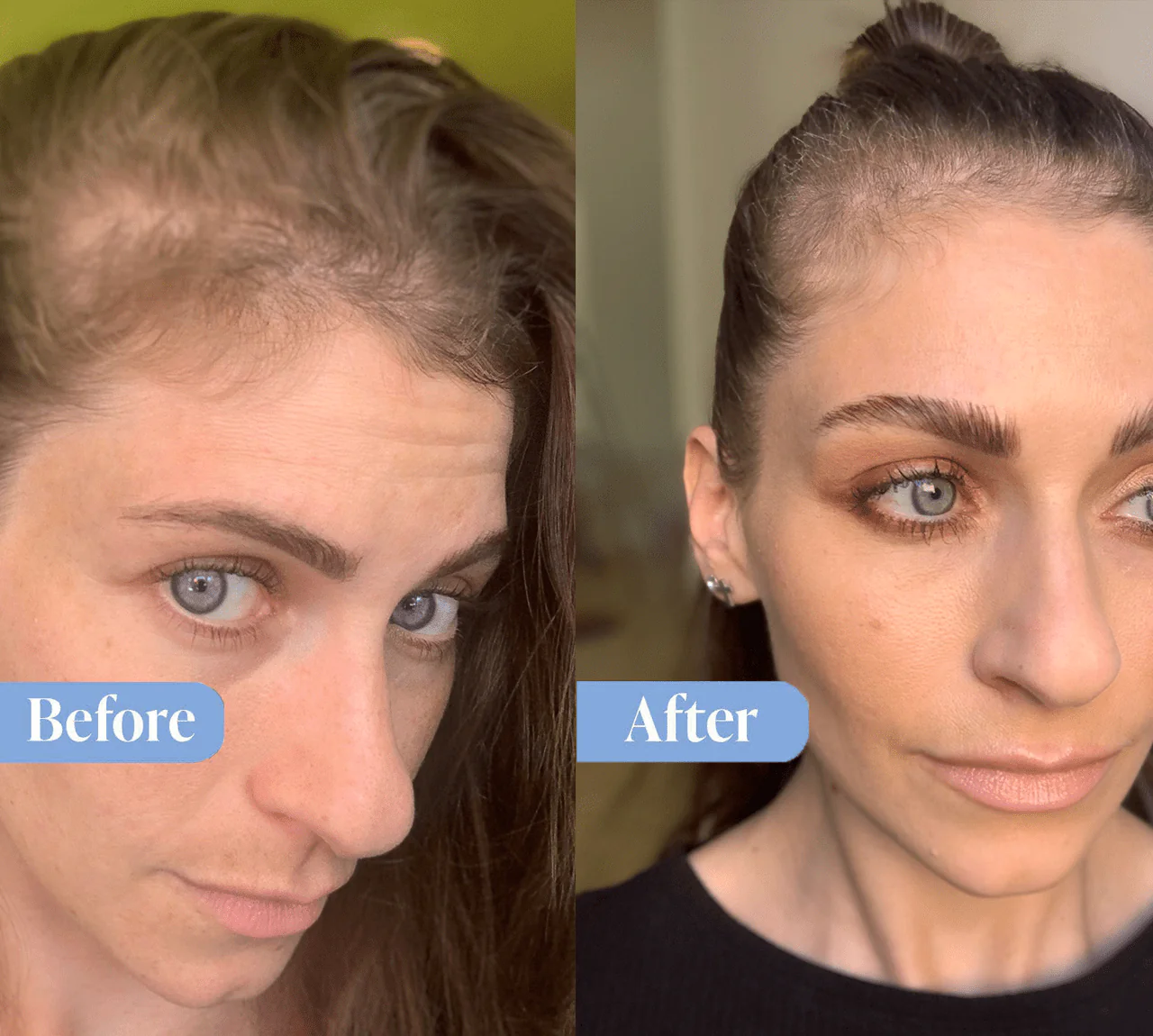 Anti-Hair Loss Repair Bundle - Image 6