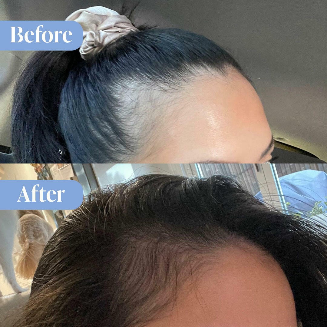 Anti-Hair Loss Repair Bundle (Free Conditioner Included) - Image 4