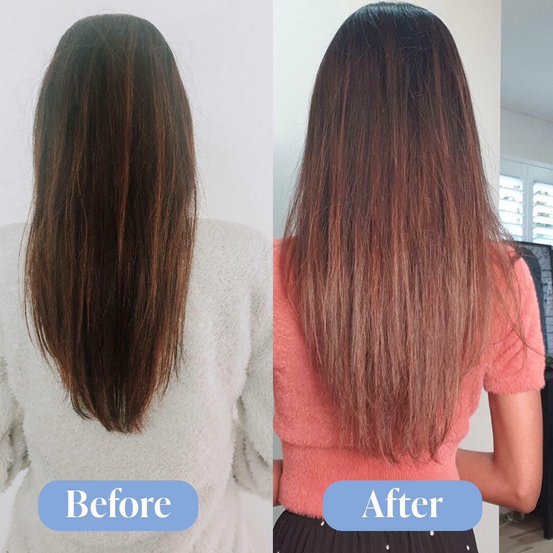 Anti-Hair Loss Treatment Bundle - Image 5